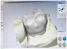 「セレック」 の 3Dデータ画面 「セレック」 の 3Dデータ画面