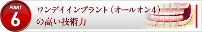 ワンデイインプラント（オールオン４）の高い技術力