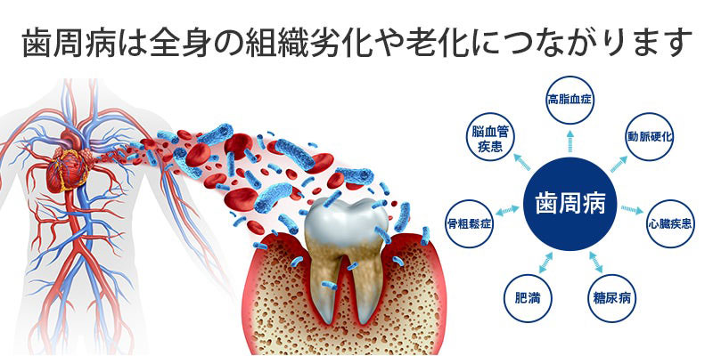 歯周病は血管から侵入し全身の組織の劣化や老化を招く