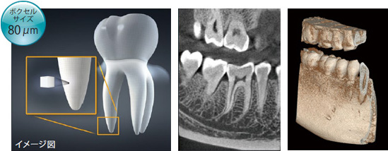 最新の歯科用CT エクセラスマート