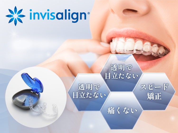 invisalign-インビザライン-は透明で目立たない・痛くない・取り外しができて清潔