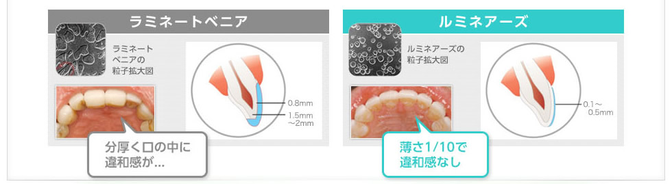 分厚く口の中に違和感が、薄さ1/10で違和感なし