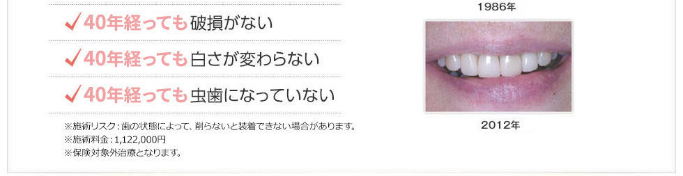 40年経っても破損が無い、40年経っても白さが変わらない、40年経っても虫歯になっていない 40年経っても虫歯になっていない