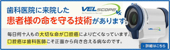 ベルスコープ